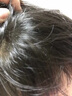童貝恩騷子藥滅虱子兒童跳蚤藥小孩頭上長虱子藥女孩頭發(fā)上有廝子戒虱凈 虱立清 曬單實(shí)拍圖