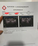 宮諾小月子玉靈飲可搭坐月子營養(yǎng)品小產(chǎn)后補品氣血人流補調(diào)理恢復(fù)15天 小月子養(yǎng)復(fù)飲6盒（香港中醫(yī)藥研發(fā) 曬單實拍圖
