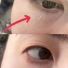 南京同仁堂脂肪粒去除神器眼部專用去眼部脂肪粒黑眼圈清肌顆粒眼部精華液 專攻眼部脂肪粒*30ml【1瓶】 曬單實(shí)拍圖