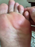 腳出汗腳臭專用的藥冬天汗腳止汗神器除腳臭克星狼毒治腳氣噴霧劑 特效：一盒【止汗凈味】 曬單實(shí)拍圖