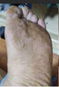 澳烏態(tài)官方正品芬寧澳烏態(tài)腳臭除臭去腳汗腳氣異味皮膚外用噴劑男女通用 買(mǎi)二送一（實(shí)發(fā)3盒）輕度型 曬單實(shí)拍圖