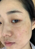 同仁堂美白祛斑霜淡化黑色素去雀斑黃褐斑老年斑曬斑男女士補水保濕面霜 1瓶裝【強力祛除各種斑】 曬單實拍圖
