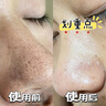 愛(ài)蘭歌娜【黑頭克星】竹炭去黑頭鼻貼撕拉面膜收縮毛孔粉刺溫和控油男女士 【買(mǎi)1送1】 100g 曬單實(shí)拍圖