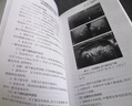 超聲掌中寶 肌骨超聲診斷 曬單實(shí)拍圖