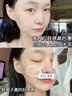 愛蘭歌娜377美白淡斑面膜提亮膚色保濕補(bǔ)水抗皺緊致抗衰老女男士官方正品 377面膜 10片 2盒+美白面膜5片 曬單實(shí)拍圖