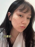 妍瑟水楊酸壬二酸凝膠15%祛痘印修復淡化去痘痘和痘印去黑頭收縮毛孔 2支裝【水楊酸】綠瓶 曬單實(shí)拍圖