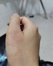 藤石制藥油燙傷去黑印紅印熱油燙傷燒傷疤痕修復(fù)去色素專用去疤膏凝膠VQ 三盒【周期裝】買2送1 曬單實拍圖