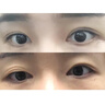 腫眼泡去脂消腫眼皮下垂提拉緊致水貼眼霜眼袋消浮腫上眼瞼松弛 腫眼泡去脂肪神器眼霜 【1支】【買(mǎi)二發(fā)三】 曬單實(shí)拍圖