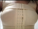 有顆桃隆胸術(shù)后假體內(nèi)衣胸托乳房重建手術(shù)無鋼圈專用手術(shù)文胸束胸衣束乳 M23103膚色束乳帶+胸托兩件套 XL 115斤至125斤拍XL碼 曬單實(shí)拍圖