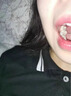 無(wú)品牌補(bǔ)牙洞齒神器材料永久自己在家補(bǔ)牙樹脂補(bǔ)牙齒修復(fù)凝膠潔離劑醫(yī)用 買2送1【3倍堅(jiān)固不怕燙 曬單實(shí)拍圖