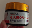 膚研祛斑霜美i白淡化老年黃褐雀斑黑色素斑臉部手背祛斑專用去老人斑 特效 一盒【醫(yī)用正品】日本技術(shù) 祛斑效果最好的產(chǎn)品 曬單實(shí)拍圖