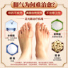 九芝堂足光散腳氣藥老牌子治腳氣泡腳止癢脫皮真菌感染汗腳角化型手足癬蘚臭汗癥爛腳丫腳臭清熱燥濕殺蟲(chóng)斂 5盒 九芝堂足光散(更多人選擇)【腳氣嚴重患者】 曬單實(shí)拍圖