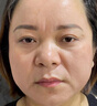 同仁堂祛斑霜美白煙酰胺377去黑色素淡化老年斑黃褐斑雀斑曬斑男女專用 1瓶【強(qiáng)效去除各種斑】 曬單實(shí)拍圖