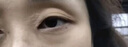 內(nèi)廷上用瞼黃瘤專(zhuān)用膏藥眼瞼黃瘤去除眼角瞼黃疣神器去脂肪粒眼皮黃斑瘤膏 特效：一盒裝 曬單實(shí)拍圖