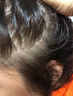 宜心男士頭頂補(bǔ)發(fā)片男頭頂補(bǔ)發(fā)塊假發(fā)片男真發(fā)發(fā)際線遮蓋白發(fā)自然透氣 自然款 【仿膚遞針】全真發(fā)16*18 曬單實(shí)拍圖
