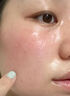 靚膚寶（LIANGFUBAO）洋甘菊舒緩特護(hù)五件套補(bǔ)水保濕緩解肌膚干癢護(hù)膚品水乳套盒 修護(hù)保濕精華液 曬單實(shí)拍圖