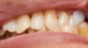 補(bǔ)牙齒神器材料永久自己在家補(bǔ)牙洞樹脂醫(yī)用臨時填充劑假牙套牙縫 補(bǔ)牙齒神器 【一瓶裝】【送補(bǔ)牙工具】 曬單實(shí)拍圖