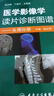 醫學(xué)影像學(xué)讀片診斷圖譜：頭頸分冊 曬單實(shí)拍圖