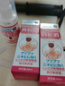 日本新薬株式會社日本京都藥業(yè)背粒消去背部痘噴霧前胸口后背部痘印祛黑頭去除螨蟲 一瓶【買二送一】 曬單實拍圖