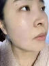 清熱解毒去痤瘡?fù)枘樕先ザ欢坏乃庰畀復(fù)桁疃荒摪挴徬掳图t腫硬去痘痘和痘印修復(fù)淡化痘印去粉刺 清熱暗瘡?fù)?發(fā)一盒紅霉i素軟膏 曬單實拍圖
