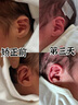 艾妮心新生嬰兒兒童愛美耳夾硅膠耳廓貼非耳朵矯正器耳型環(huán)縮耳垂耳隱耳 單一只C款耳塞+膠帶+指導 曬單實拍圖