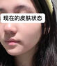 安美奇安美奇橄欖姜黃搭祛痘凈痘消痘印坑閉 一盒裝【體驗(yàn)裝，建議買三發(fā)四】 曬單實(shí)拍圖