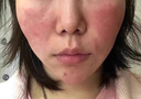 祛斑后修復(fù)凍干粉 免調(diào)配多肽修復(fù)凍干粉祛痘痘印煙酰胺精華原液淡化黑斑紅血絲抗i衰軟膏官方店旗艦 曬單實(shí)拍圖