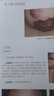 中國皮膚病性病圖鑒 朱學(xué)駿白癜風(fēng)痤瘡病因與實(shí)用治療皮膚性病學(xué)科醫學(xué)美容中國臨床皮膚病學(xué)管理書(shū)籍專(zhuān)業(yè)知識病理醫生皮膚病書(shū)籍 曬單實(shí)拍圖