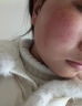喬記本草臉過(guò)敏干癢紅修復(fù)專用面膜過(guò)敏癢紅腫敏感肌術(shù)后修復(fù)冷敷貼械字號(hào) 一盒裝【醫(yī)用敷料】 曬單實(shí)拍圖