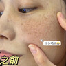 MERCILEN377美白祛斑霜去斑美白淡化老年斑黃褐雀斑黑色素曬斑面霜男女士 煙酰胺美白提亮去黃改善暗沉膚色 曬單實(shí)拍圖