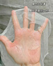 適科膚 SKIN SUIT醫(yī)用冷敷貼積雪草玻尿酸面膜術(shù)后修復(fù)冷敷敷料降溫美容院同款 適科膚醫(yī)用冷敷型 二十盒裝100片 曬單實(shí)拍圖