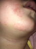 絲凱麗爐甘石寶寶倍護舒緩膏/寶寶溫和修復膏兒童皮膚過敏紅屁股 16g/支 一歲以上爐甘石寶寶倍護舒緩膏 1盒裝/16g*1 曬單實拍圖
