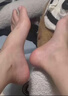 腳氣噴霧劑治嚴重腳氣藥止癢脫皮爛腳丫真菌感染治腳氣特藥皮膚用藥腳趾縫爛癢水泡鹽酸特比萘芬噴霧劑 3瓶【腳真菌感染 反復腳氣 對癥治療】藥師推薦 國藥正品 藥房直發(fā)-腳氣噴劑-角化型干裂腳氣藥 曬單實(shí)拍圖