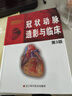 冠狀動(dòng)脈造影與臨床（第3版） 曬單實(shí)拍圖