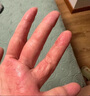 醫(yī)康方仁地松樟薄乳膏上海皮膚科醫(yī)院軟膏20gKK【藥房直售】 1支 曬單實(shí)拍圖