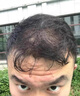 同仁堂【1滴不掉發(fā)】育發(fā)液防脫發(fā)育發(fā)濃密增長(cháng)液中草藥激活毛囊增密發(fā) 買(mǎi)2送1【針對中度脫發(fā)】增發(fā)密發(fā) 曬單實(shí)拍圖