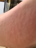 金稻熱噴蒸臉器納米離子噴霧補(bǔ)水儀面部蒸汽機(jī)美容儀蒸臉儀家用打開毛孔清潔補(bǔ)水器 【熱噴款】加長升級(至尊版)-家用\院用\移動美容 曬單實拍圖