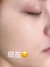 老中醫(yī)呼喚美白祛斑套裝 補水保濕白皙細膩肌膚改善色素淡斑祛斑護膚品 潔面膏+水+精華+乳液+霜+防曬 曬單實拍圖