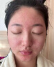VKR喜藏藏皂正品除螨手工皂痘痘修復(fù)消炎痘印男女通用香皂祛痘沐浴皂 喜藏藏皂正品一盒【100g】 藏藥入皂功效加倍 曬單實(shí)拍圖