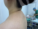 奧蘭尚富貴包副乳術(shù)后一期專(zhuān)用彈力塑身衣沒(méi)吸脂抽脂作用后背加壓緊身衣 膚色 S 曬單實(shí)拍圖