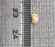 WARSA華硰德國原裝進口強力消石素膽腎結(jié)石特效化石溶石排石藥膽囊結(jié)石適用120粒 【腎結(jié)石適用】3瓶周期裝 曬單實拍圖
