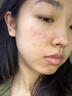 王老吉 清熱暗瘡片 清熱解毒涼血散瘀中藥內(nèi)調(diào)去痘痘治痤瘡去粉刺 5盒*24片【療程裝 】痤瘡粉刺 曬單實(shí)拍圖
