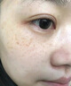 同仁堂（TRT）美白祛斑面霜淡化黑色素去斑黃褐斑雀斑曬斑女士用的最好產(chǎn)品正品 1瓶體驗裝【強效祛除各種斑】 曬單實(shí)拍圖