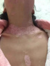 WUMEIDING【白斑白塊】烏梅酊抑菌液專(zhuān)注白癜白斑白塊促黑色素再生肌膚本色 【高濃度】烏梅酊50ml*2瓶 曬單實(shí)拍圖