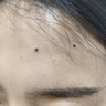 骉祥非激光點(diǎn)扁平疣儀器美容院去除點(diǎn)痣筆膏面部脖子祛瘊子肉粒絲狀疣y 液晶款玫瑰紅藍(lán)光款 液晶款土豪金藍(lán)光款 曬單實(shí)拍圖