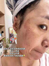 同仁堂祛斑霜正品淡化黑色素去斑祛雀斑曬斑黃褐斑老年斑保濕面霜男女士 強效祛斑【多瓶使用效果更好】 曬單實(shí)拍圖