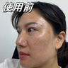 施奈芙美白淡斑面膜提亮膚色保濕滋潤美白吸斑撕拉型面膜黃褐斑雀斑男女 100ML*1瓶【初次嘗試】 曬單實(shí)拍圖