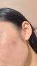 樂(lè )家老鋪志清清搭溫和點(diǎn)痣藥水痕疤液祛痣膏黑痣雀斑去痣專(zhuān)用臉部不留疤 1盒裝【溫和不留疤】痣少-小痣-雀斑適用 點(diǎn)痣膏正品點(diǎn)痣無(wú)痛無(wú)痕去痣膏點(diǎn)疣點(diǎn)痣膏 曬單實(shí)拍圖