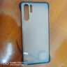尋幟梵 適用oppoA93手機(jī)殼透明防摔無邊框A93s保護(hù)套殼超薄硬殼透氣散熱純色簡約裸機(jī)男女新款 【高透無邊框】-散熱防摔-不發(fā)黃 oppoA93 曬單實(shí)拍圖