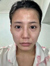 EMYA黑繃帶】玻色因抗皺輕齡霜女士抗皺淡紋面霜早晚霜官方正品 【抗皺周期裝】輕齡霜3瓶150g 曬單實拍圖